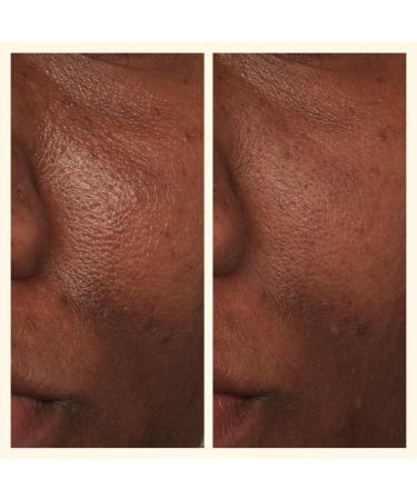 Beekman 1802 Potato Peel Rapid Resurfacing Milk Facial - Transform Your Style with the Best Innovation Today! - Buy Online on GoSupps.com