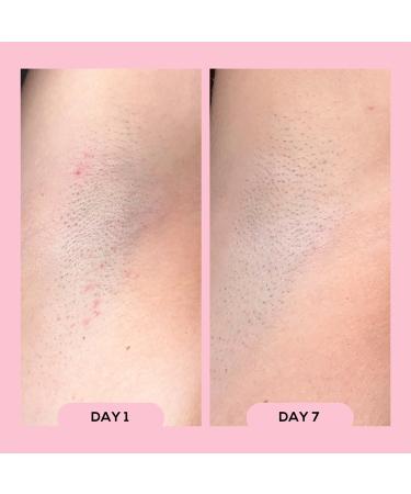 Discover megababe AprÃ¨s Shave - Ingrown Hair & Razor Bump Roll-On 3 oz - Elevate Your Style Instantly! - Buy Online on GoSupps.com