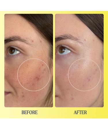 Kinship Brightwave 10% Vitamin C + Peptide Brightening Serum 1.0 oz - Transform Your Style with the Best Innovation Today! - Buy Online on GoSupps.com