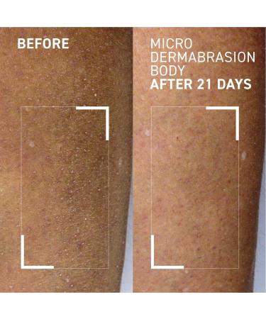 Discover Dr. Brandt Microdermbrasion Body Polishing Exfoliator 3.5 oz - Elevate Your Style Instantly! - Buy Online on GoSupps.com