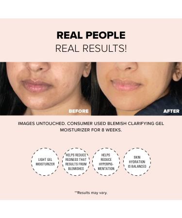 Discover NUDESTIX Nudeskin Blemish Clarifying Gel Moisturizer 2.03 oz - Elevate Your Style Instantly! - Buy Online on GoSupps.com