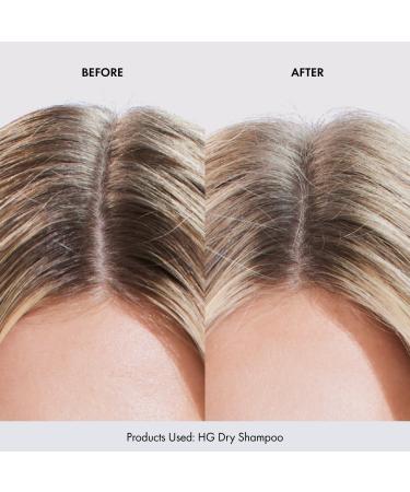 Bondi Boost HG Volumizing Dry Shampoo - Transform Your Style with the Best Innovation Today! - Buy Online on GoSupps.com
