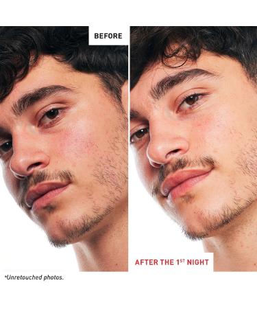 Erborian Skin Therapy Multi-Perfecting Night Oil-Serum 1.01 oz - Transform Your Style with the Best Innovation Today! - Buy Online on GoSupps.com