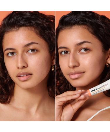 Discover Hero Cosmetics Rescue Balm +Dark Spot Retouch Post-Blemish Recovery Cream 0.5 oz - Elevate Your Style Instantly! - Buy Online on GoSupps.com