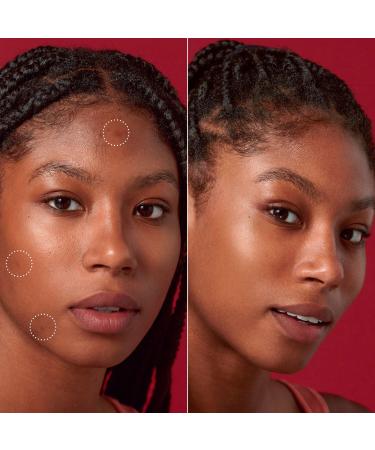 Discover Hero Cosmetics Rescue Balm +Dark Spot Retouch Post-Blemish Recovery Cream 0.5 oz - Elevate Your Style Instantly! - Buy Online on GoSupps.com