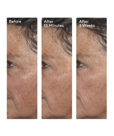 Murad 5 Minute Fix: Targeted Correctors Set - Discover Premium Quality Shop now! - Buy Online on GoSupps.com