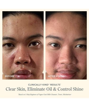 Discover Beekman 1802 Oil Eliminating Foaming Gel Cleanser 4.0 oz - Elevate Your Style Instantly! - Buy Online on GoSupps.com