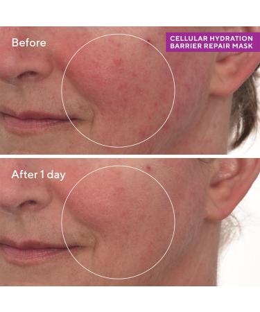 Discover Murad Cellular Hydration Barrier Repair Mask 2.7 oz - Elevate Your Style Instantly! - Buy Online on GoSupps.com
