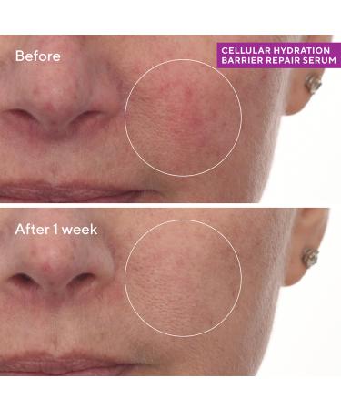 Murad Cellular Hydration Barrier Repair Serum 1.0 oz - Transform Your Style with the Best Innovation Today! - Buy Online on GoSupps.com