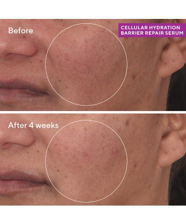 Murad Cellular Hydration Barrier Repair Serum 1.0 oz - Transform Your Style with the Best Innovation Today! - Buy Online on GoSupps.com