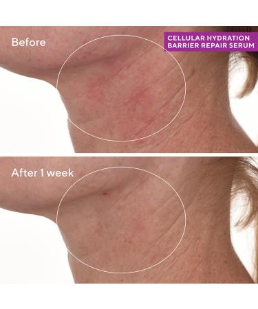 Murad Cellular Hydration Barrier Repair Serum 1.0 oz - Transform Your Style with the Best Innovation Today! - Buy Online on GoSupps.com
