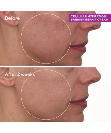 Murad Cellular Hydration Barrier Repair Cream 1.7 oz - Transform Your Style with the Best Innovation Today! - Buy Online on GoSupps.com