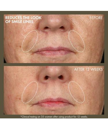 Origins Plantscription Active Wrinkle Correction Retinoid Serum 1.6 oz - Discover Premium Quality Shop now! - Buy Online on GoSupps.com