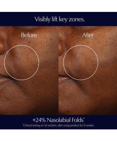 EstÃ©e Lauder Perfectionist Pro Rapid Firm + Lift Serum 1.0 oz - Transform Your Style with the Best Innovation Today! - Buy Online on GoSupps.com