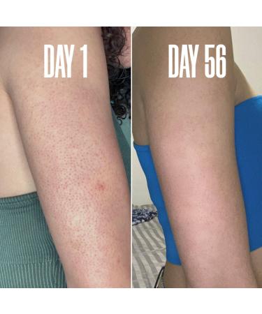 Discover MAÃ‹LYS RE-START Resurfacing Body Serum 3.5 oz - Elevate Your Style Instantly! - Buy Online on GoSupps.com
