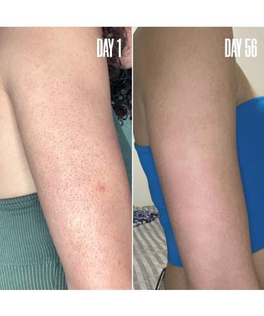 Discover MAÃ‹LYS RE-START Resurfacing Body Serum 3.5 oz - Elevate Your Style Instantly! - Buy Online on GoSupps.com