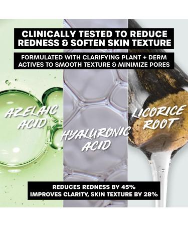 Discover Thayers Let's Be Clear Water Cream for Combination to Oily Skin 2.5 oz - Elevate Your Style Instantly! - Buy Online on GoSupps.com