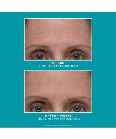 Discover Peter Thomas Roth Peptide Skinjection Amplified Wrinkle-Fix Serum 1.0 oz - Elevate Your Style Instantly! - Buy Online on GoSupps.com