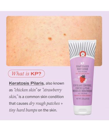 First Aid Beauty Travel Size KP Bump Eraser Body Scrub Fresh Strawberry 2.0 oz - Transform Your Style with the Best Innovation Today! - Buy Online on GoSupps.com