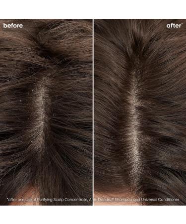 Biolage Scalp Sync Purifying Scalp Concentrate 6.8 oz - Transform Your Style with the Best Innovation Today! - Buy Online on GoSupps.com