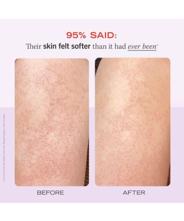Discover First Aid Beauty KP Bump Eraser Body Scrub Fresh Strawberry 8.0 oz - Elevate Your Style Instantly! - Buy Online on GoSupps.com