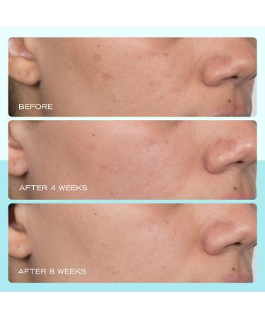 Discover First Aid Beauty Facial Radiance Niacinamide Dark Spot Serum 1.0 oz - Elevate Your Style Instantly! - Buy Online on GoSupps.com