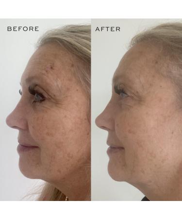 Discover DIME Dark Spot Corrector 1.7 oz - Elevate Your Style Instantly! - Buy Online on GoSupps.com