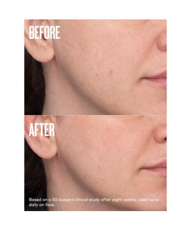 Beautycounter All Bright Dark Spot Minimizer 0.5 oz - Transform Your Style with the Best Innovation Today! - Buy Online on GoSupps.com