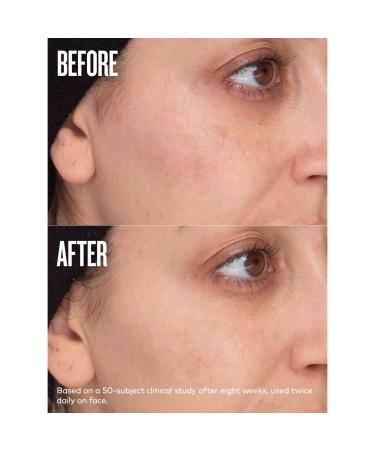 Beautycounter All Bright Dark Spot Minimizer 0.5 oz - Transform Your Style with the Best Innovation Today! - Buy Online on GoSupps.com