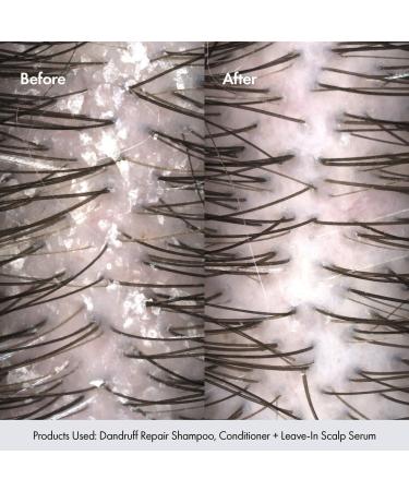 Bondi Boost Dandruff Repair Conditioner with 2% Salicylic Acid - Discover Premium Quality Shop now! - Buy Online on GoSupps.com