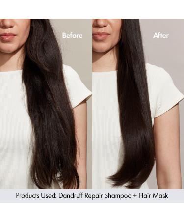 Discover Bondi Boost Dandruff Repair Hair Mask with 2% Salicylic Acid - Elevate Your Style Instantly! - Buy Online on GoSupps.com