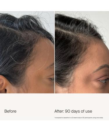 Discover Living Proof Scalp Care Density Serum 1.7 oz - Elevate Your Style Instantly! - Buy Online on GoSupps.com
