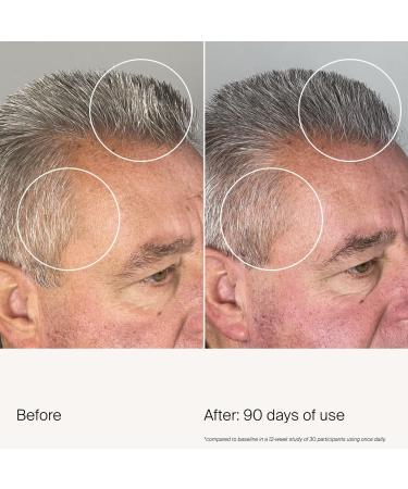 Discover Living Proof Scalp Care Density Serum 1.7 oz - Elevate Your Style Instantly! - Buy Online on GoSupps.com