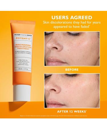 Discover Peter Thomas Roth Potent-C Niacinamide Discoloration Treatment - Elevate Your Style Instantly! - Buy Online on GoSupps.com