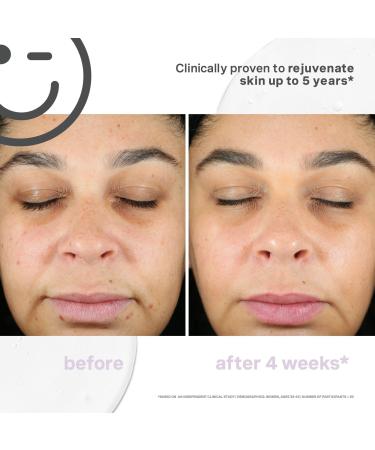 Kate Somerville KateCeuticals SuperCell Rejuvenation Serum 1.0 oz - Transform Your Style with the Best Innovation Today! - Buy Online on GoSupps.com