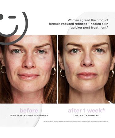 Kate Somerville KateCeuticals SuperCell Rejuvenation Serum 1.0 oz - Transform Your Style with the Best Innovation Today! - Buy Online on GoSupps.com