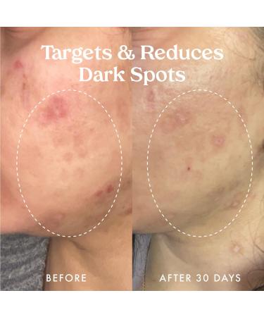 Discover Kopari Beauty Star Bright Vitamin C Discoloration Correcting Serum 1.0 oz - Elevate Your Style Instantly! - Buy Online on GoSupps.com