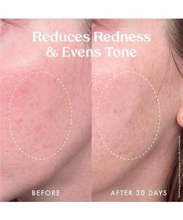 Discover Kopari Beauty Star Bright Vitamin C Discoloration Correcting Serum 1.0 oz - Elevate Your Style Instantly! - Buy Online on GoSupps.com