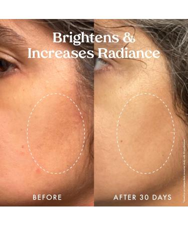 Discover Kopari Beauty Star Bright Vitamin C Discoloration Correcting Serum 1.0 oz - Elevate Your Style Instantly! - Buy Online on GoSupps.com