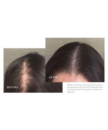 Discover Virtue Flourish Minoxidil 5% Foam for Hair Growth 1 ct - Elevate Your Style Instantly! - Buy Online on GoSupps.com