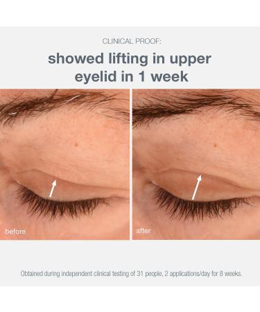 Dermalogica Phyto Nature Lifting Eye Cream 0.50 oz - Discover Premium Quality Shop now! - Buy Online on GoSupps.com