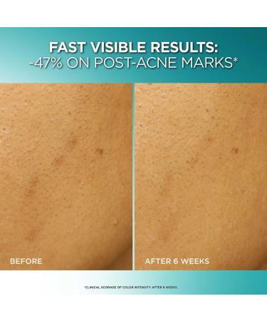 L'OrÃ©al Bright Reveal Dark Spot Exfoliant Peel 0.85 oz - Transform Your Style with the Best Innovation Today! - Buy Online on GoSupps.com