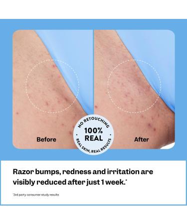 Discover Peach Slices Smoothing Solution Ingrown Hair Treatment 1.69 oz - Elevate Your Style Instantly! - Buy Online on GoSupps.com