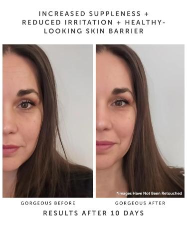 Discover Earth Harbor Horizon Ceramide Recovery Serum 0.67 oz - Elevate Your Style Instantly! - Buy Online on GoSupps.com
