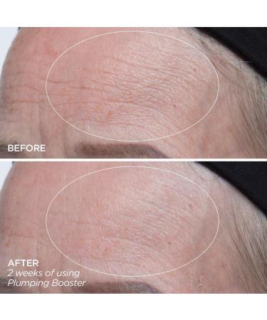 Discover BeautyBio Plumping Booster Hyaluronic Acid Supercharged Complex 1.0 oz - Elevate Your Style Instantly! - Buy Online on GoSupps.com