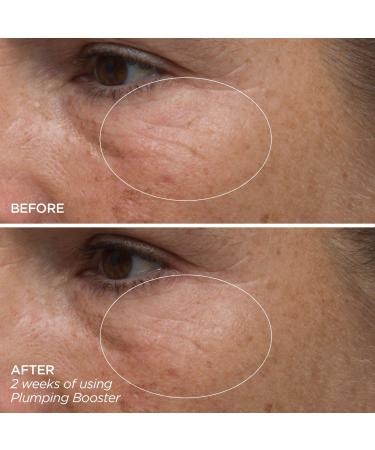 Discover BeautyBio Plumping Booster Hyaluronic Acid Supercharged Complex 1.0 oz - Elevate Your Style Instantly! - Buy Online on GoSupps.com