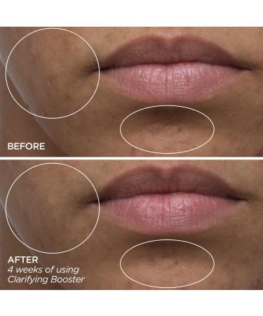 Discover BeautyBio Clarifying Booster - Salicylic Acid Treatment Serum 1.0 oz - Elevate Your Style Instantly! - Buy Online on GoSupps.com