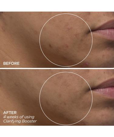 Discover BeautyBio Clarifying Booster - Salicylic Acid Treatment Serum 1.0 oz - Elevate Your Style Instantly! - Buy Online on GoSupps.com