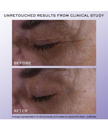 Discover LancÃ´me RÃ©nergie H.C.F. Triple Serum Eye 0.67 oz - Elevate Your Style Instantly! - Buy Online on GoSupps.com