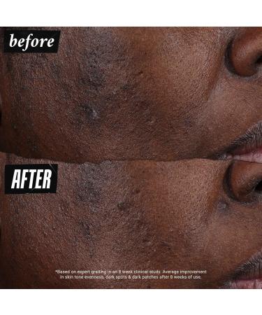 Kiehl's Since 1851 Auto-Tone Discoloration & UV Solution SPF 30 1.4 oz - Transform Your Style with the Best Innovation Today! - Buy Online on GoSupps.com